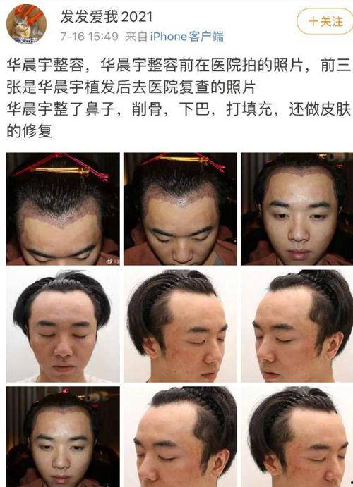 成都整形爆料事件最新,揭秘行业乱象与患者权益受损真相 第2张 成都整形爆料事件最新,揭秘行业乱象与患者权益受损真相 第2张